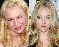 15 Seleb Hollywood Ini pun Terserang Jerawat (Bag. 2)