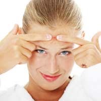 1 dari 6 Wanita Putus Asa Karena Jerawatnya