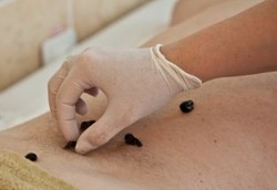 Apa Jadinya Kalau Lintah Masuk ke Tubuh?