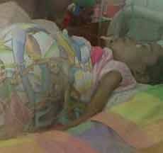 Perut Membesar 50 Cm, Bocah Usia 5 Tahun Tak Kuasa Melawan Tumor