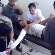 Peralatan Las Meledak, Tangan & Kaki Honorer Pemkab Terbakar