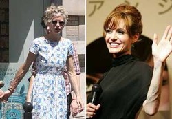 Dari Cantik Jadi Seram Karena Pembuluh Darah yang Menonjol