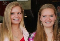 Gadis Kembar Cermin, Identik Tapi Organnya Saling Berlawanan