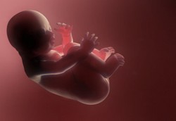 2,5 Juta Janin Tiap Tahun Menjerit Karena Dimatikan