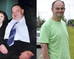 Pria Ini Sukses Turunkan 93 Kg Pasca Divonis Akan Segera Tutup Usia