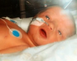 Sedih! Baru Lahir 2 Jam, Bayi Ini Sudah Mengidap Kanker