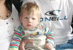 Terlahir Tanpa Bisa Tersenyum, Menangis dan Berkedip