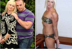 Bangga Berat Badan Turun Drastis, Tak Tahunya Karena Kanker Usus