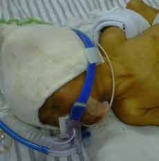 Otak Bayi Berkembang 80 Persen Saat Usia 2 Tahun