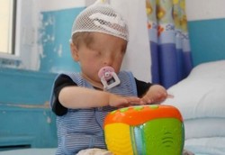 Terlahir Tanpa Bola Mata