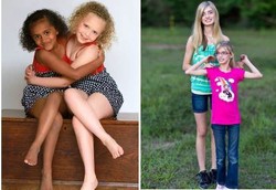 Beginilah Hidup si Kembar yang Tidak Kembar