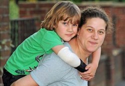 Bocah 7 Tahun Kena Stroke Karena Menderita Cacar Air