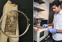 Tato Gigi Pendeteksi Penyakit akan Segera Hadir