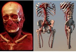 Ini Bedanya Rontgen Saat Ini dengan Masa Depan