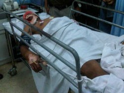 Drum di Tanjung Duren Meledak Saat Dilas