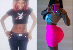 Setelah Kecanduan Silikon, Perempuan Ini Kini Takut Mati