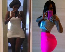 Wanita Ini Habiskan Rp 141 Juta Untuk Punya Bokong Super Besar