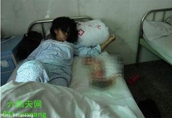 Gambar Aborsi Paksa yang Menggemparkan China