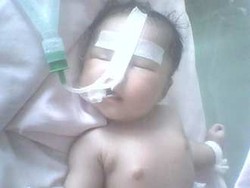  Nafas Sesak, Diva Bayi Penderita Jantung Bocor Masuk ICU Lagi