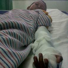 Ali Terjepit Eskalator PGS Karena Kaos