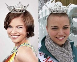 Demi Aksi Kemanusiaan, Ratu Kecantikan Botaki Kepalanya