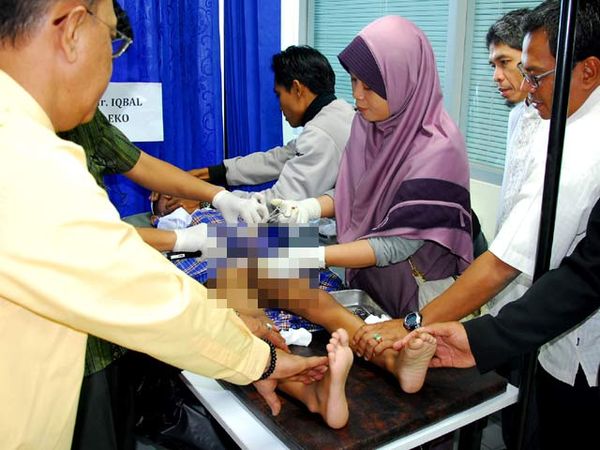 AHM Gelar Khitanan Massal untuk Anak Yatim