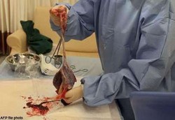 Ibu Makan Sup Plasenta Bayi Usai Melahirkan Kembali Marak