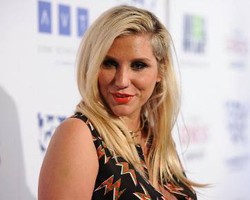 Kesha Pamer Foto Tato di Bibir