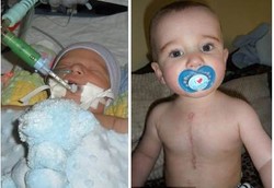 Balita Malang yang Terlahir dengan 6 Cacat Jantung Sekaligus