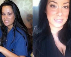 Baru Berusia 24 Tahun, Wanita Ini Sudah Ketagihan Botoks