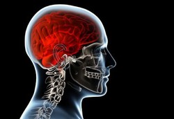 Selebritas yang Tertonjok Stroke