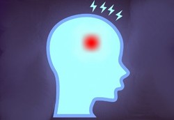 Stroke Kini Mengincar Orang Muda yang Gaul