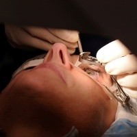 Sembuhkan Katarak Pakai Energi Ultrasonic