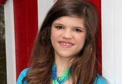 Cewek yang Tak Pernah Nangis Karena Kebal Sakit dan Nyeri Sejak Bayi