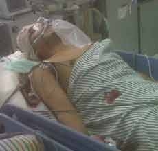 Suami Istri Sekarat Dicarok Orang Tak Dikenal