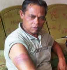 Pasca Bentrok Dengan TNI, Warga Malang Lakukan Visum 