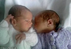 Kembar Tapi Lahir di Negara yang Berbeda