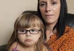 Balita Ini akan Kritis Jika Makan Cokelat