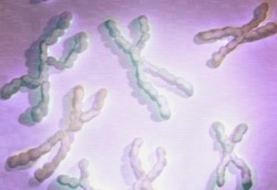 Sindrom DiGeorge, Gangguan Kromosom 22