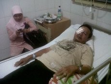 Pyar! Kaca KA Gumarang Pecah Dilempar Batu, 1 Penumpang Terluka
