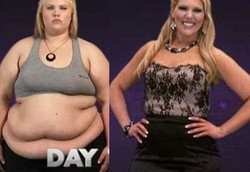 Potret Perjuangan Melawan Perut Gelambir Jadi Ramping