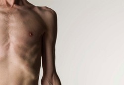 Orang Kurus Ternyata Jauh Lebih Tak Sehat Dibanding Orang Gemuk