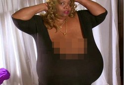 Wanita dengan Payudara Terbesar di Dunia Tak Bisa Menyusui