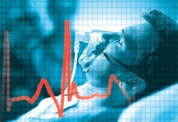 Sindrom Brugada, Gangguan Irama Jantung