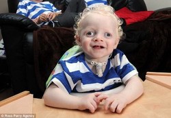 Bocah yang Tak Pernah Tidur dan Tak Bisa Melihat