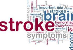 Stroke Lebih Mematikan di Akhir Pekan