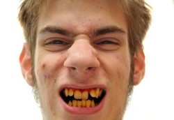 Ini Dia Minuman Penyebab Noda di Gigi Selain Kopi