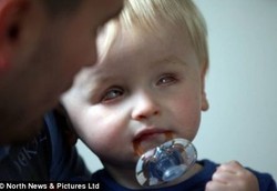 Bocah ini Baru Bisa Membuka Matanya di Usia 17 Bulan