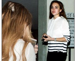 5 Selebriti yang Mengalami Kebotakan di Usia Muda