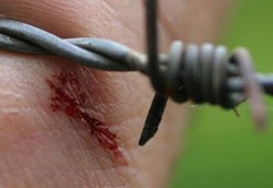 Ini Dia Jenis dan Gejala Tetanus